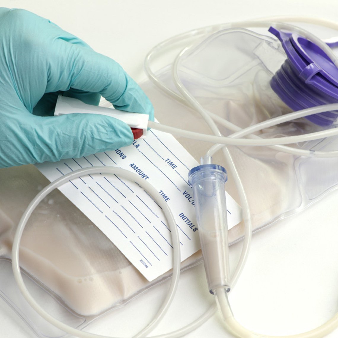 Hand in surgeon glove holding IV - Special Nutrition - AAK
