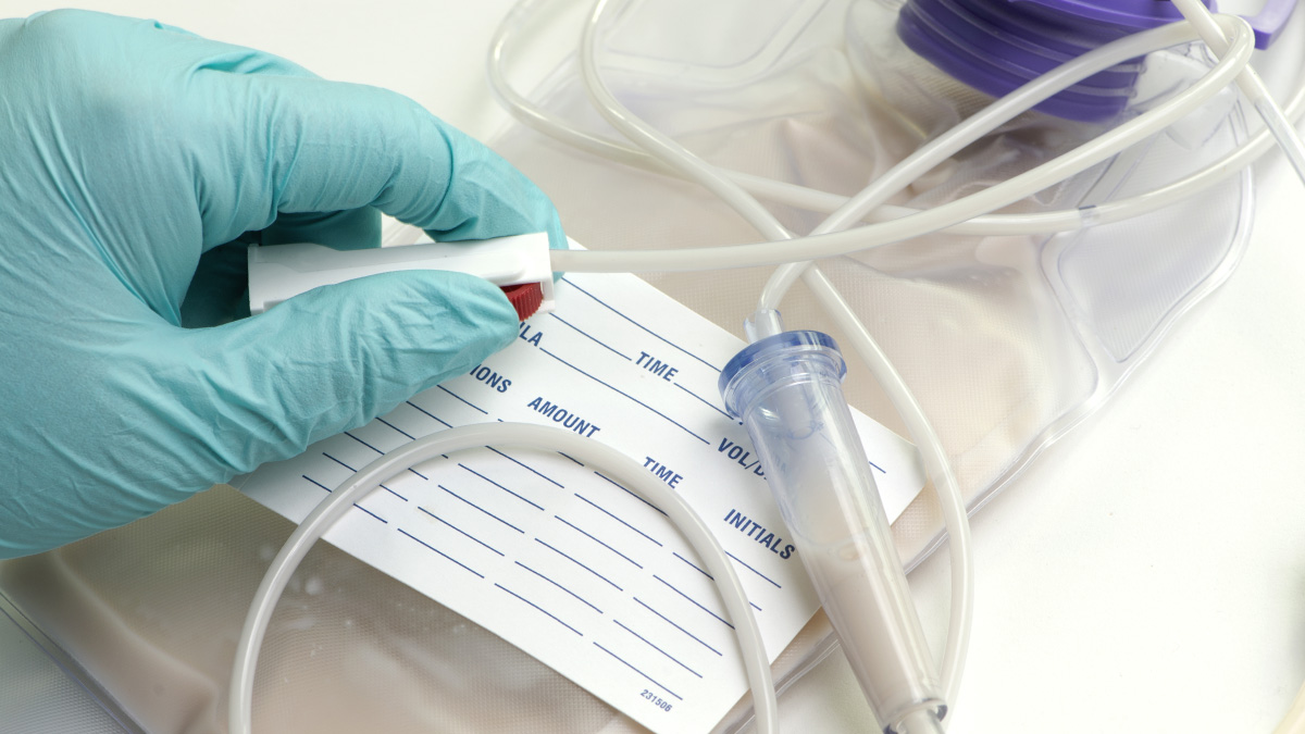 Kirurghandske på hand som håller utrustning för dropp - Special Nutrition - AAK